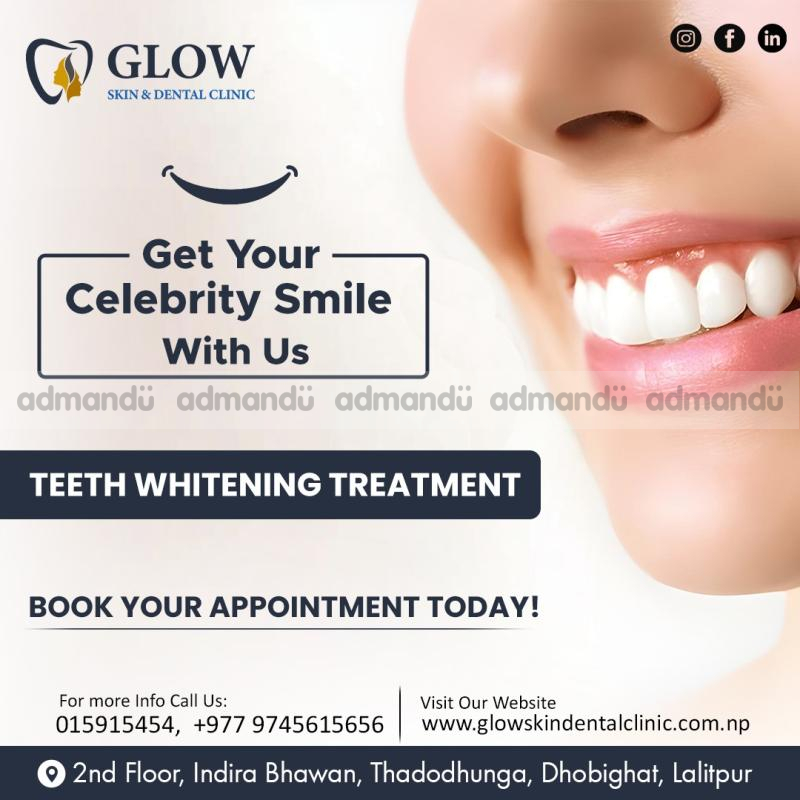 Teeth Whitening in Kathmandu – Glow Your Smile.