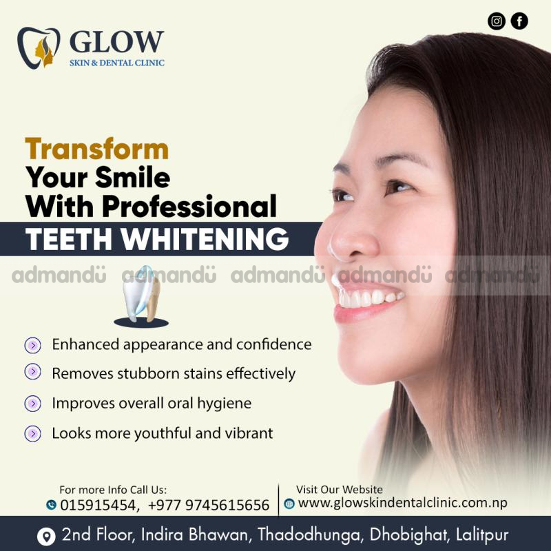 Best Teeth Whitening In Kathmandu