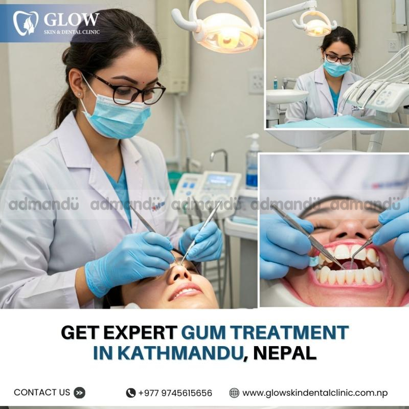 Get Expert Gum Treatment in Kathmandu, Nepal